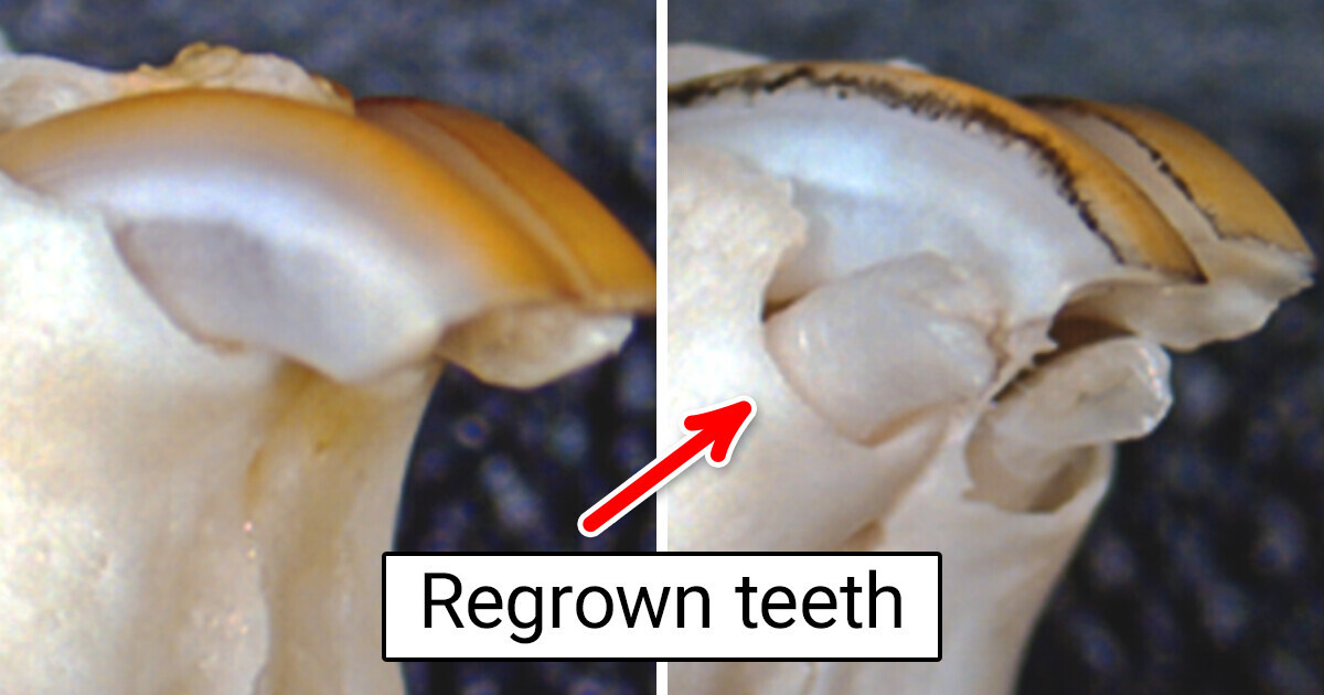We’ve All Waited for It: Scientists Created a Drug That Can Help Regrow Lost Teeth We’ve All Waited for It: Scientists Created a Drug That Can Help Regrow Lost Teeth