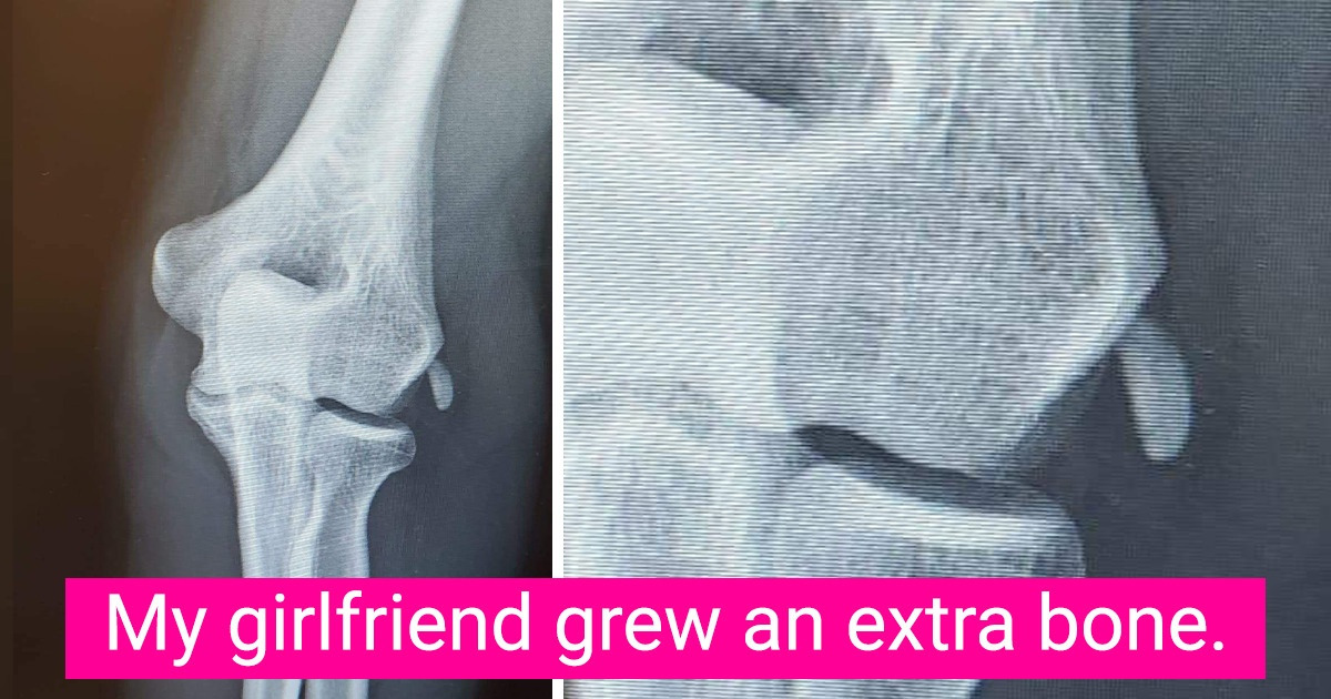 17 Photos That Left Us Wide-Eyed in Disbelief