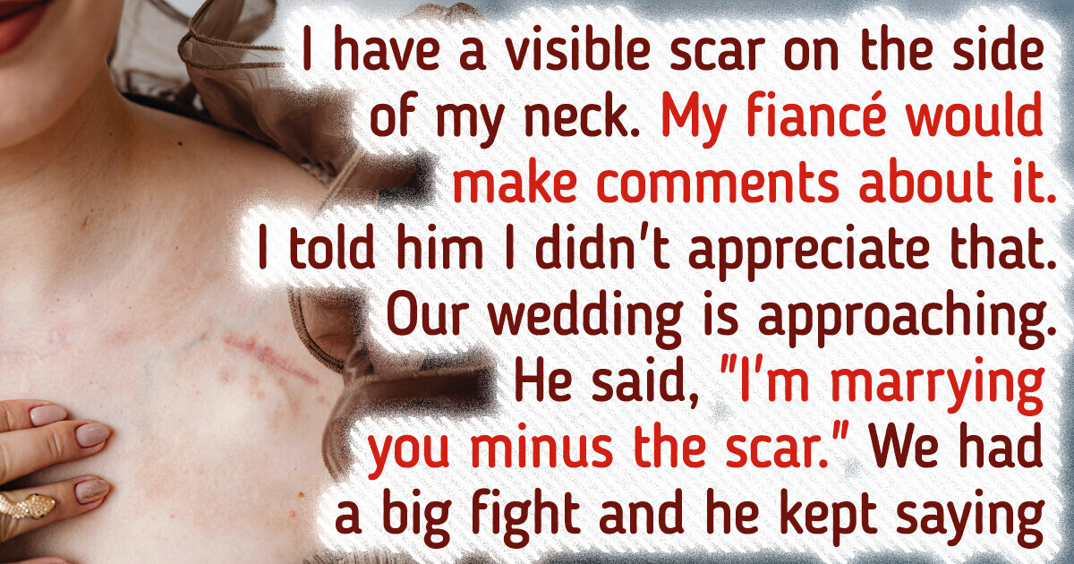 I Am Postponing the Wedding Because My Fiancé Keeps Making Comments About My Scar I Am Postponing the Wedding Because My Fiancé Keeps Making Comments About My Scar