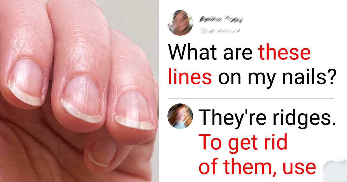 10 Ways to Achieve Healthy Nails Without Spending a Ton of Money 10 Ways to Achieve Healthy Nails Without Spending a Ton of Money