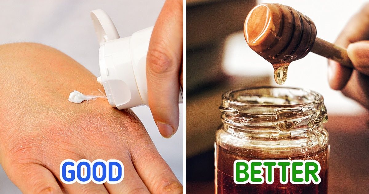 8 Ways to Save Your Dry Hands at Home 8 Ways to Save Your Dry Hands at Home