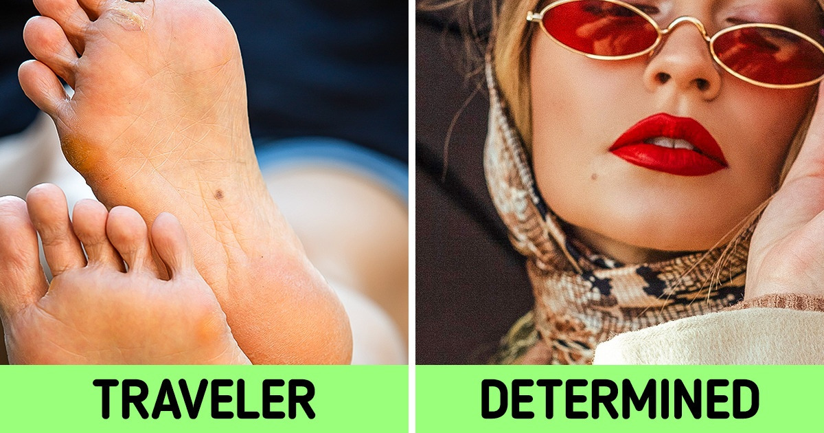 What Moles on 7 Places of Your Body Reveal About Your Personality What Moles on 7 Places of Your Body Reveal About Your Personality