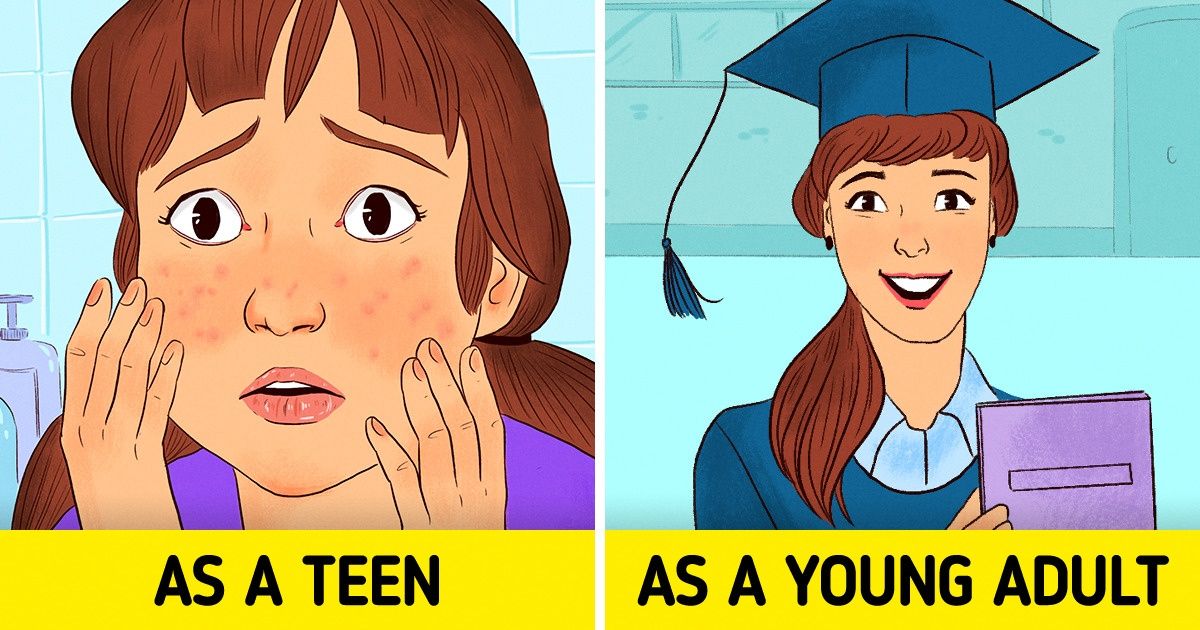 If You Had Acne as a Teen, You Have Better Chances of Becoming Successful, According to a Study If You Had Acne as a Teen, You Have Better Chances of Becoming Successful, According to a Study
