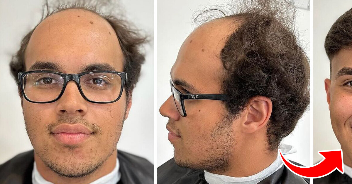 A Hairdresser Gives a New Appearance to Men Who Suffer From Hair Loss (10 Photos) A Hairdresser Gives a New Appearance to Men Who Suffer From Hair Loss (10 Photos)