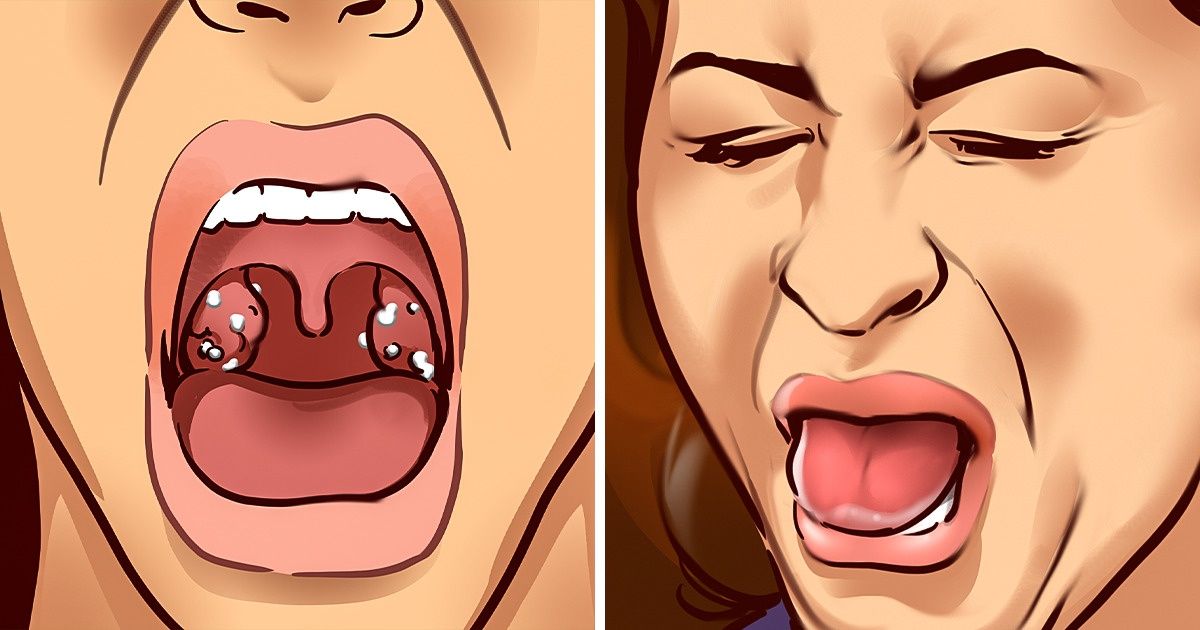 9 Things A Bad Taste In Your Mouth Is Trying To Tell You