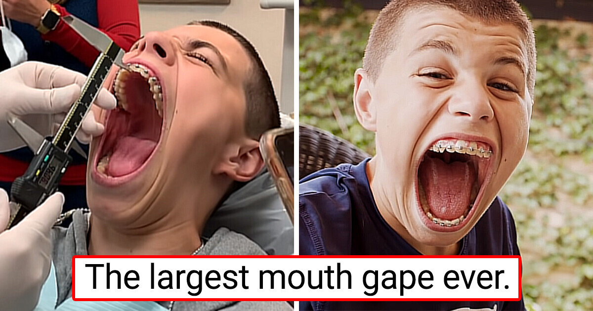15+ Extraordinary People Whose Unique Traits Turn Heads