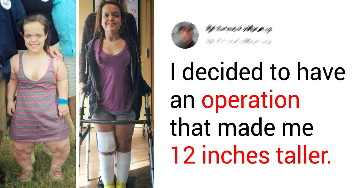 15 People Who Decided to Change Their Looks, and the Results Could Surprise Anyone 15 People Who Decided to Change Their Looks, and the Results Could Surprise Anyone