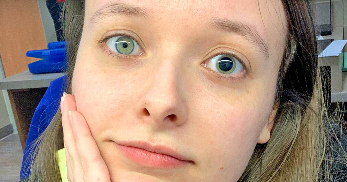 15 People Who Look Extraordinary Because of Unique Physical Features