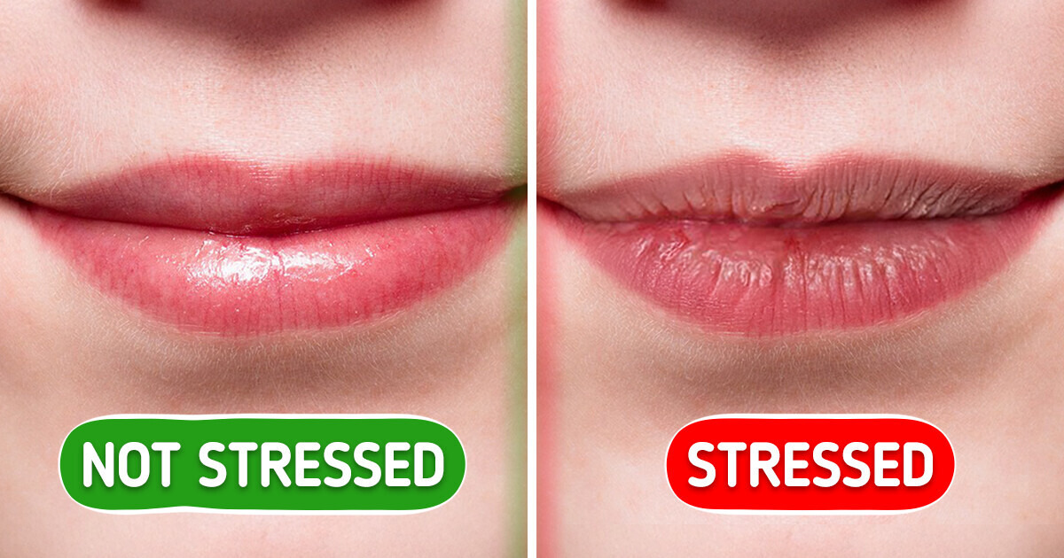 7 Signs of Stress Your Body Can Produce 7 Signs of Stress Your Body Can Produce