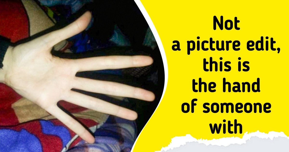 21 Pictures That Made Us Say, “Wait, What?”