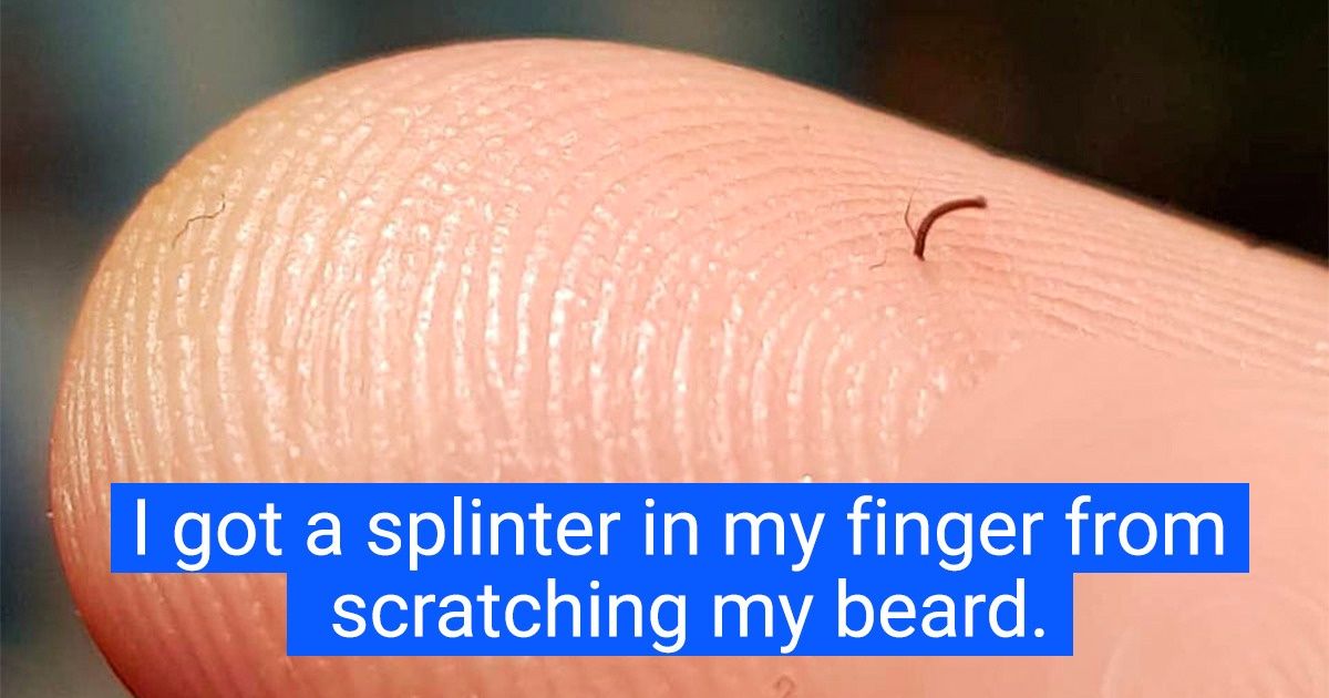 15+ Pics That Show What It’s Like to Start Your Day on the Wrong Foot