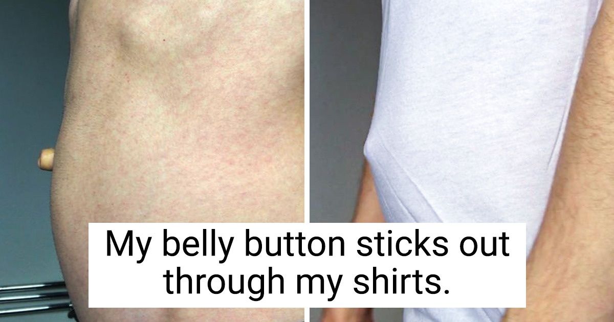 15+ People Whose Ancestors Seem to Have Been Aliens