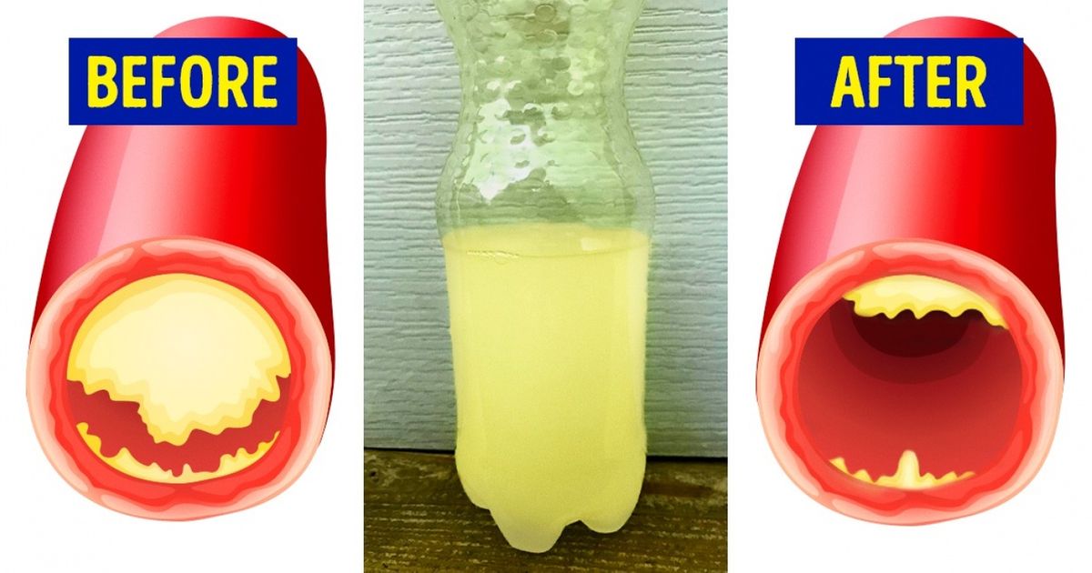15 Foods That Take Care of Your Heart and Decrease the Risk of Heart Attacks