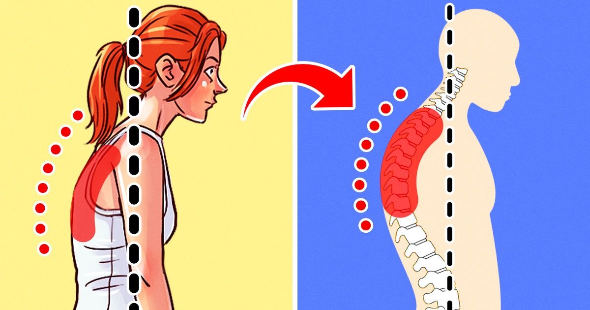 4 Types Of Poor Posture And How To Fix Each Of Them