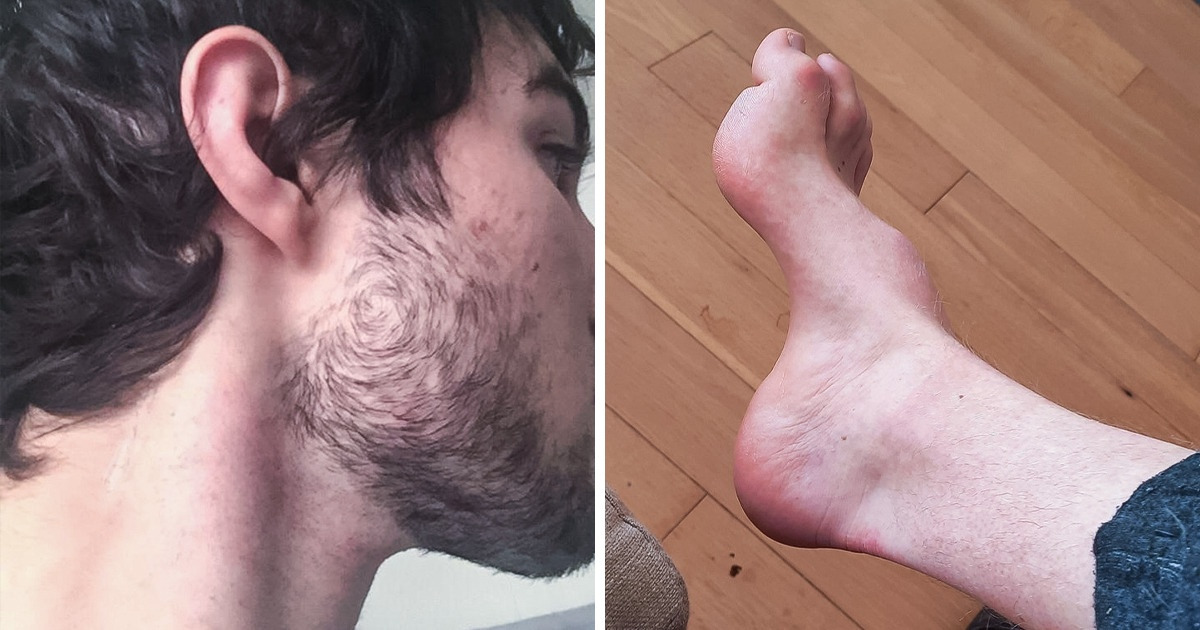 10 Rare Body Features That Can Make Us Feel Like One of a Kind