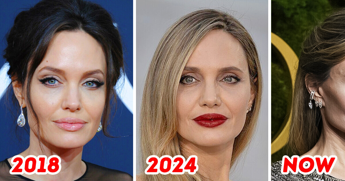 “Grey Skin,” Angelina Jolie’s New Look Leaves Fans Concerned