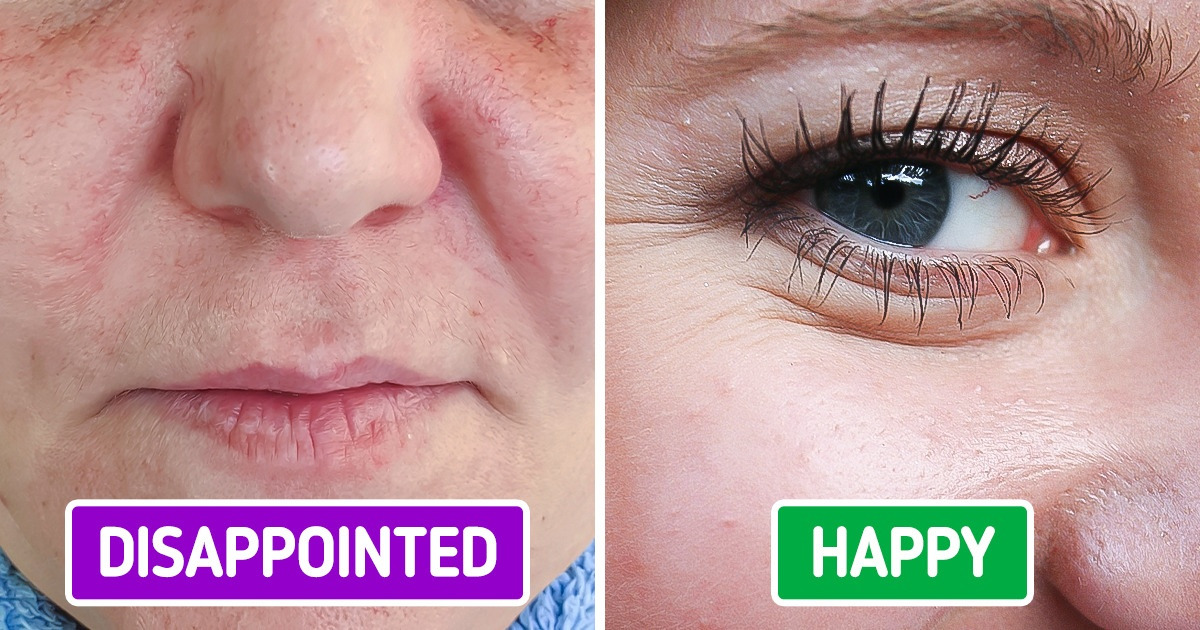 7 Ways Emotions Actually Affect Wrinkles on Your Face