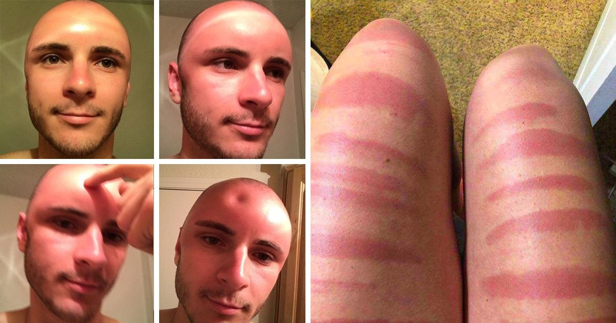 25 Desperate People Whose Lives Are Endless Disasters