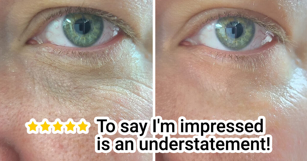 10 beauty gems from Amazon that can solve a bunch of skincare issues 10 beauty gems from Amazon that can solve a bunch of skincare issues