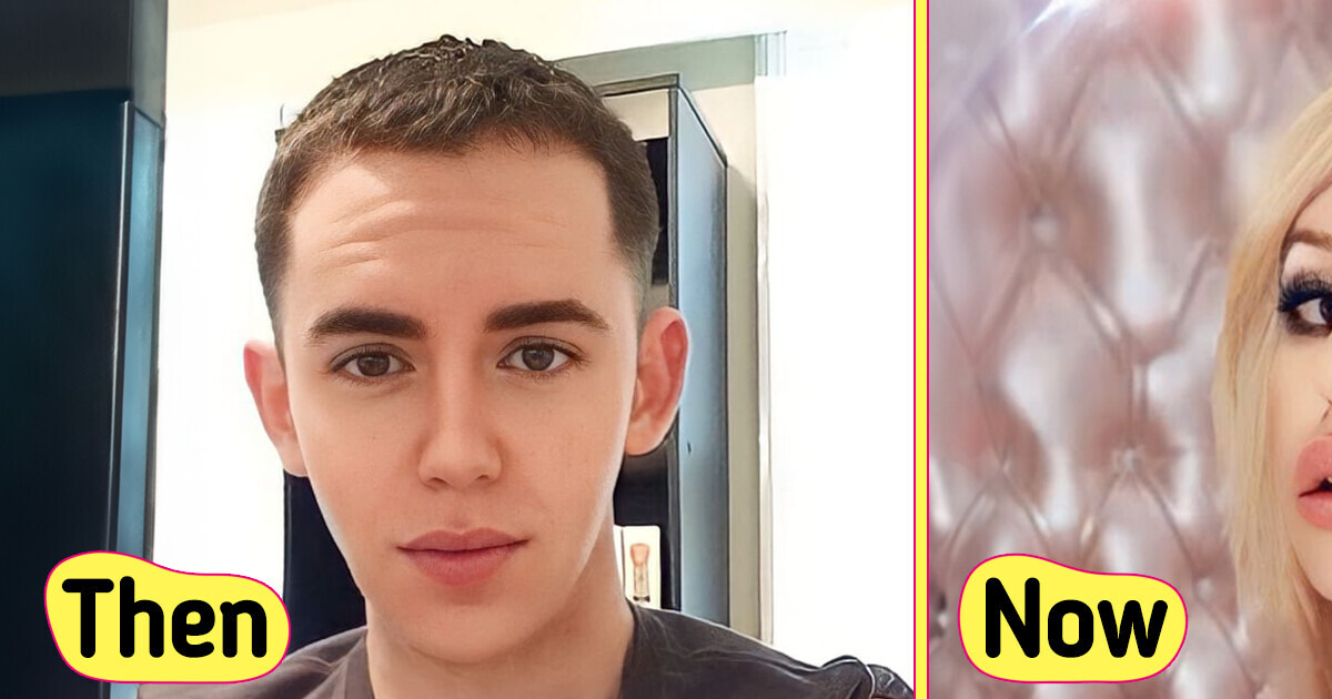I Spent Over $100.000 on Plastic Surgery to Turn Myself Into Britney Spears I Spent Over $100.000 on Plastic Surgery to Turn Myself Into Britney Spears