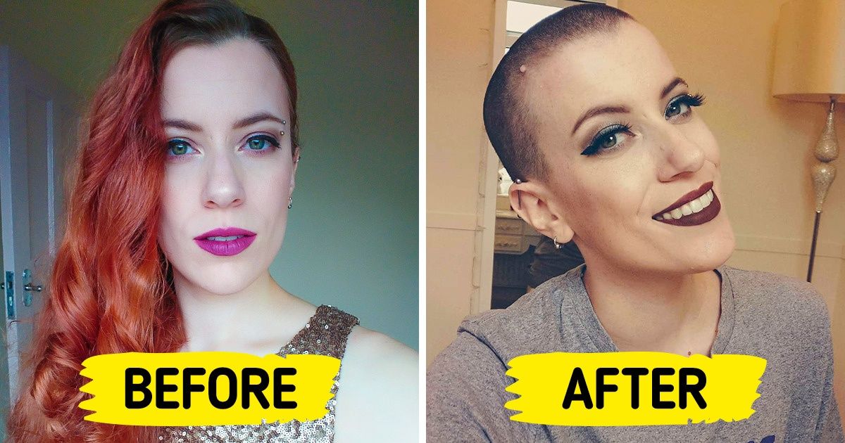 15 Women Who Went From Bald to Bold With Dazzling Charisma 15 Women Who Went From Bald to Bold With Dazzling Charisma