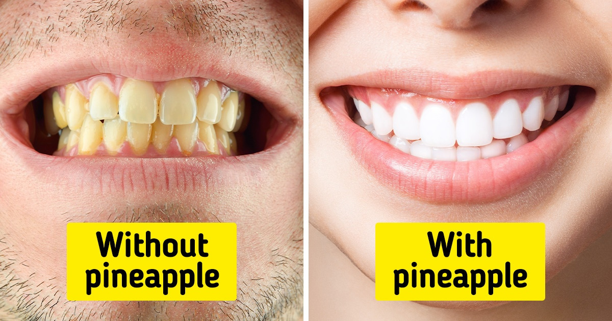 10 Tips to Help Your Teeth Look Picture Perfect