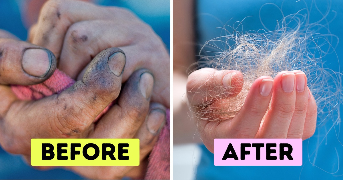 Why We Shouldn’t Use the Same Towel More Than 2 Days in a Row