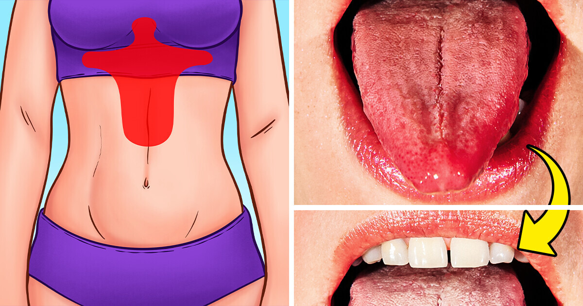8 Ways Your Body Warns You Might Have Gastritis 8 Ways Your Body Warns You Might Have Gastritis