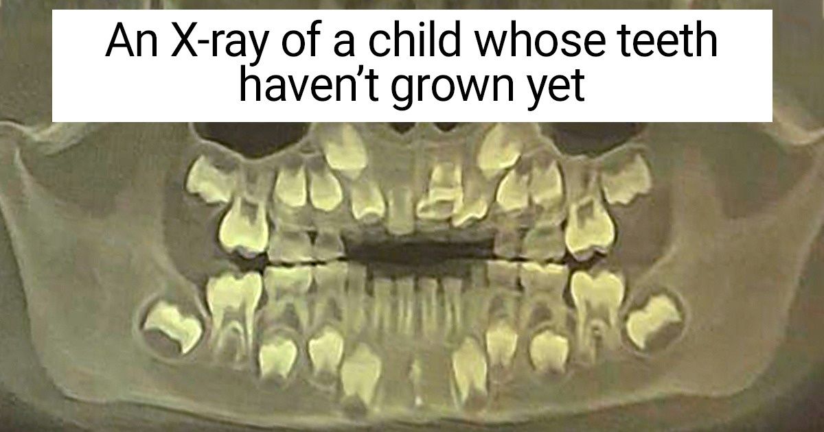 14 X-Rays That Show the Hidden Parts of Our Lives