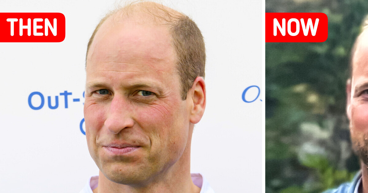 “So Handsome,” Prince William Reveals a New Look With Beard and Shocks ...