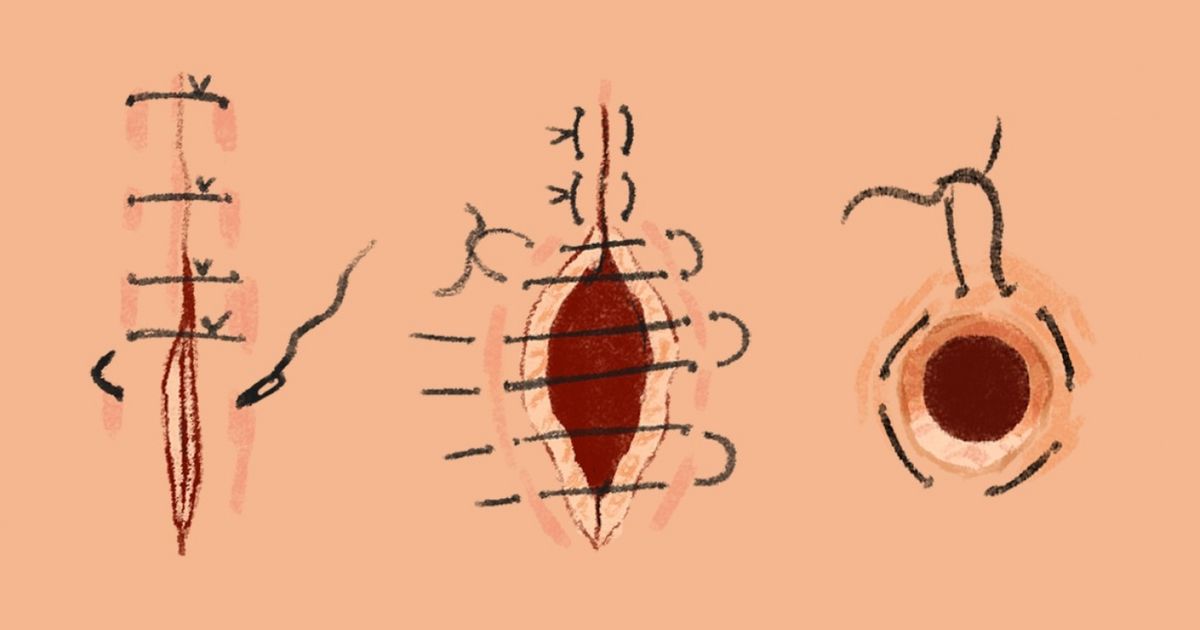 14 Tricks That Will Help You Survive a Life-or-Death Situation
