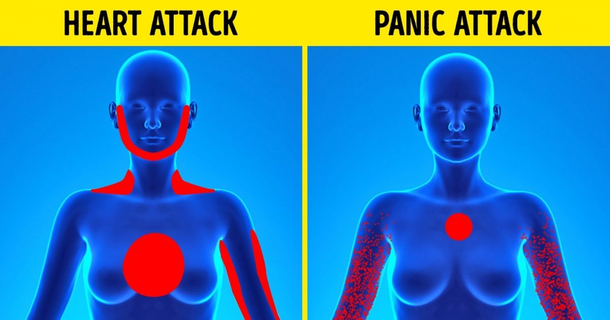 Can Severe Anxiety Mimic A Heart Attack