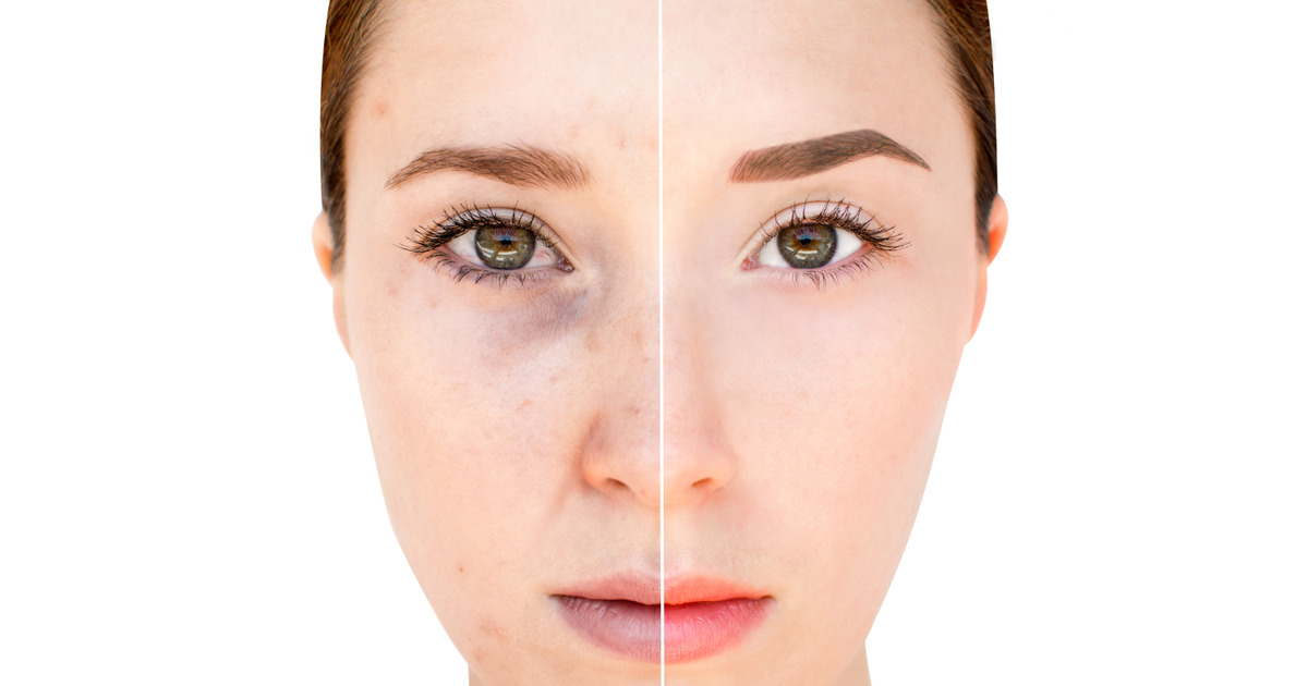 6 Examples Showing How Our Habits Affect Our Appearance