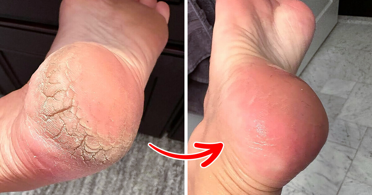10+ Amazon finds that can help you solve some truly uncomfortable beauty problems 10+ Amazon finds that can help you solve some truly uncomfortable beauty problems