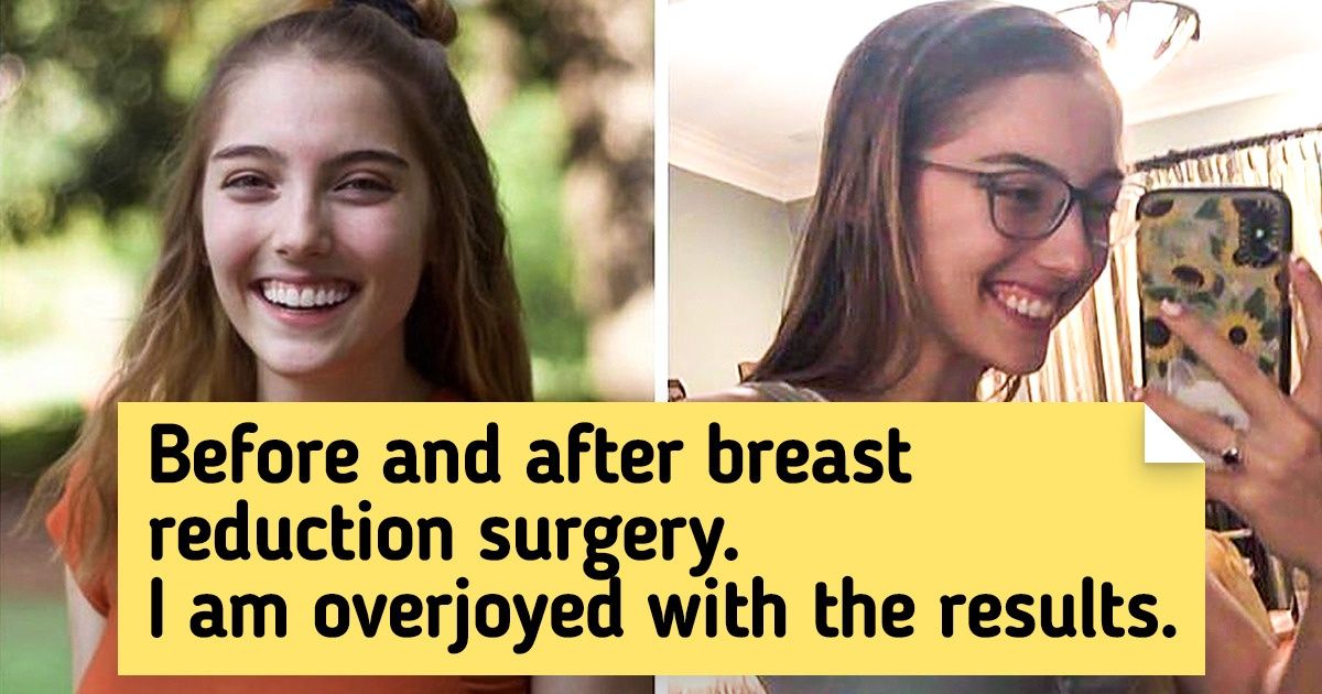 20 Before and After Photos That Showcase Progress and Hard Work 20 Before and After Photos That Showcase Progress and Hard Work