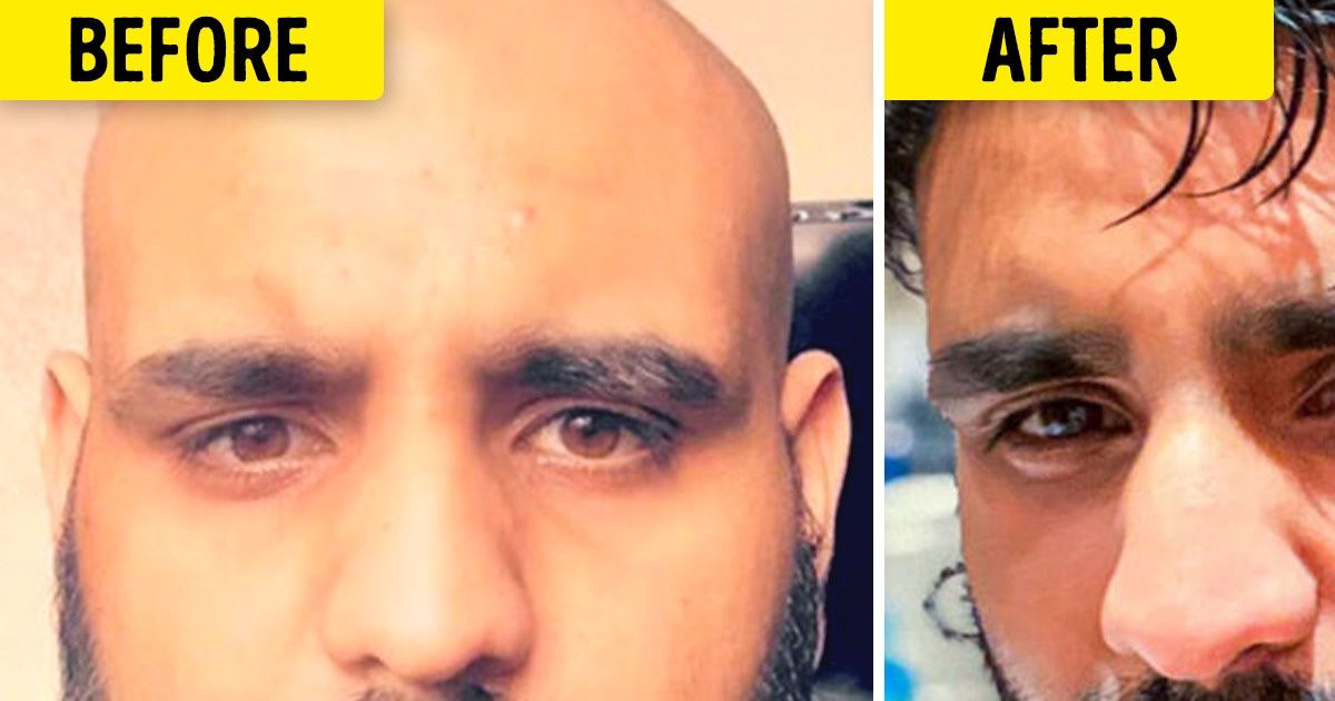 15 People Who Dared to Do What They Wanted, and the Whole World Applauded Them for It 15 People Who Dared to Do What They Wanted, and the Whole World Applauded Them for It