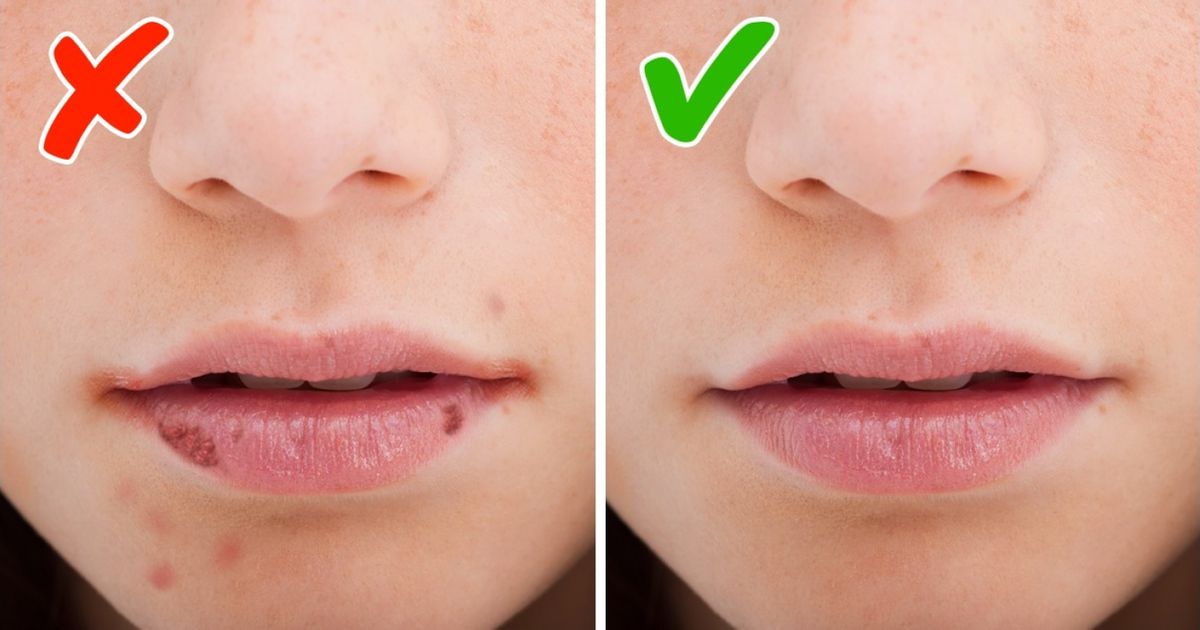 8 Signals Your Body Gives You When You Need More Vitamins