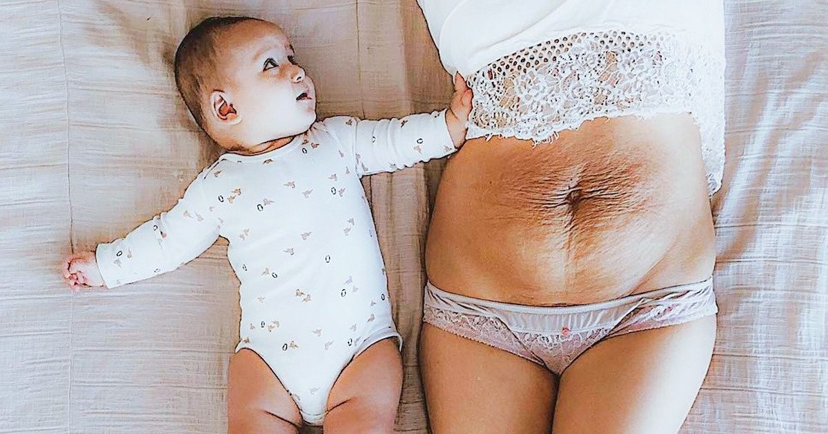 A Mother of 5 Posted Her Belly Photo to Prove the Female Body Is Always Beautiful, and the Support She Got Is Immense A Mother of 5 Posted Her Belly Photo to Prove the Female Body Is Always Beautiful, and the Support She Got Is Immense