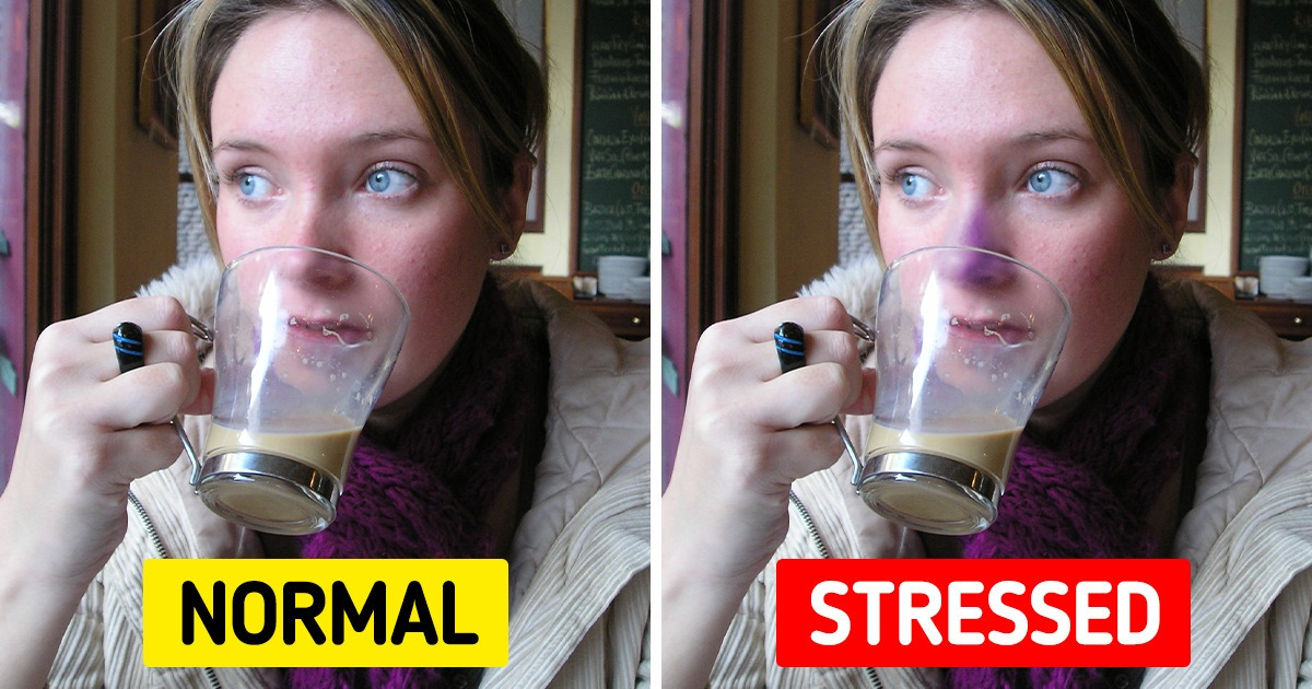 7 Signs of Stress Your Body Is Showing You