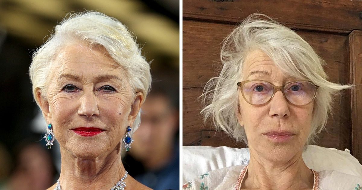 13 Times Celebrities Went 100% Filter-Free