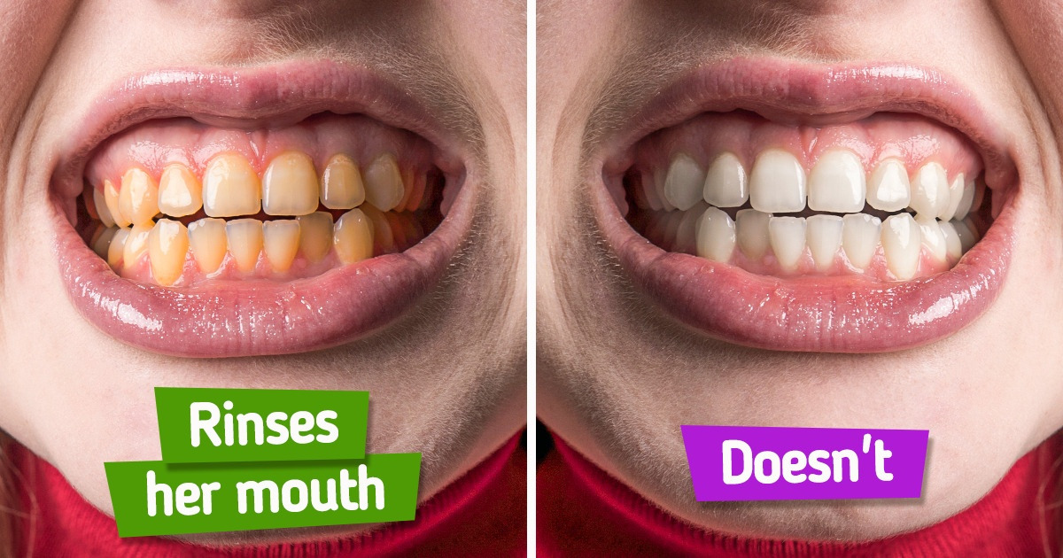 6 Toothbrushing Mistakes That Are Keeping You From Having a Hollywood Smile 6 Toothbrushing Mistakes That Are Keeping You From Having a Hollywood Smile