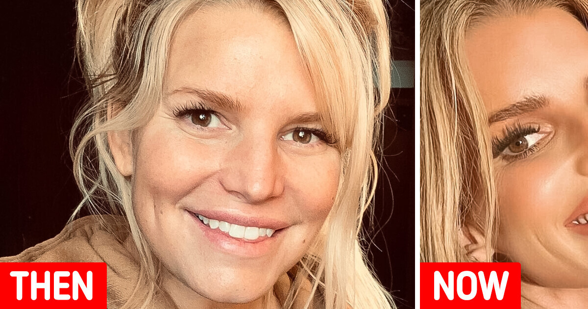 «What Did She Do to Her Lips?» Jessica Simpson’s Latest Photo Causes a Stir «What Did She Do to Her Lips?» Jessica Simpson’s Latest Photo Causes a Stir