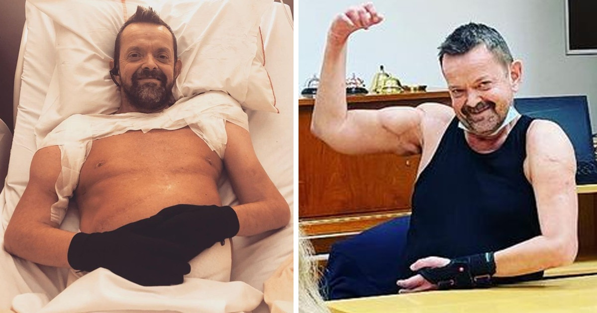 A Man Whose Arms and Shoulders Were Amputated Can Wave Again A Man Whose Arms and Shoulders Were Amputated Can Wave Again
