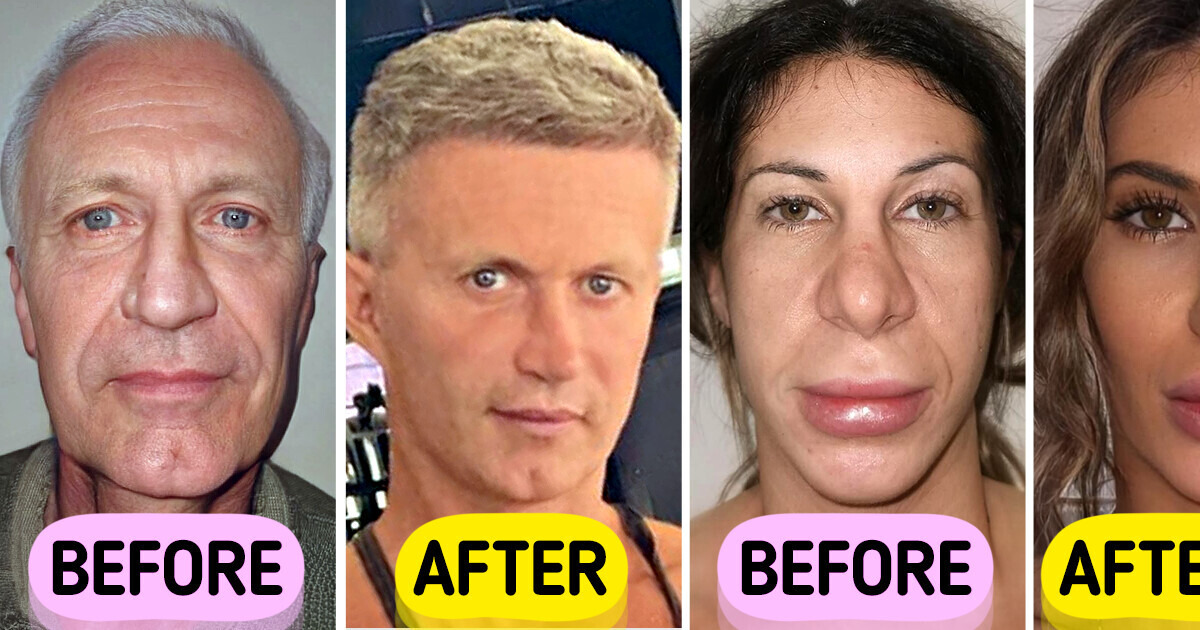 This Clinic Uses the Golden Ratio for Stunning Plastic Surgery Transformations, People Are in Awe This Clinic Uses the Golden Ratio for Stunning Plastic Surgery Transformations, People Are in Awe