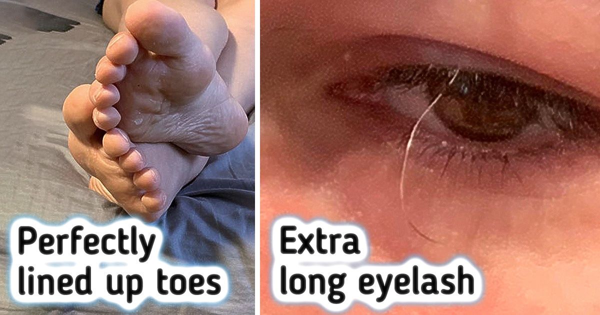 16 People Whose Bodies Are Like a Treasure Box
