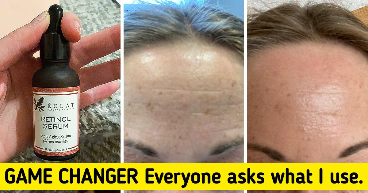 If You Want to Keep Your Skin Firm and Glowy, Consider Checking Out These 8 Quality Retinol Serums and Creams