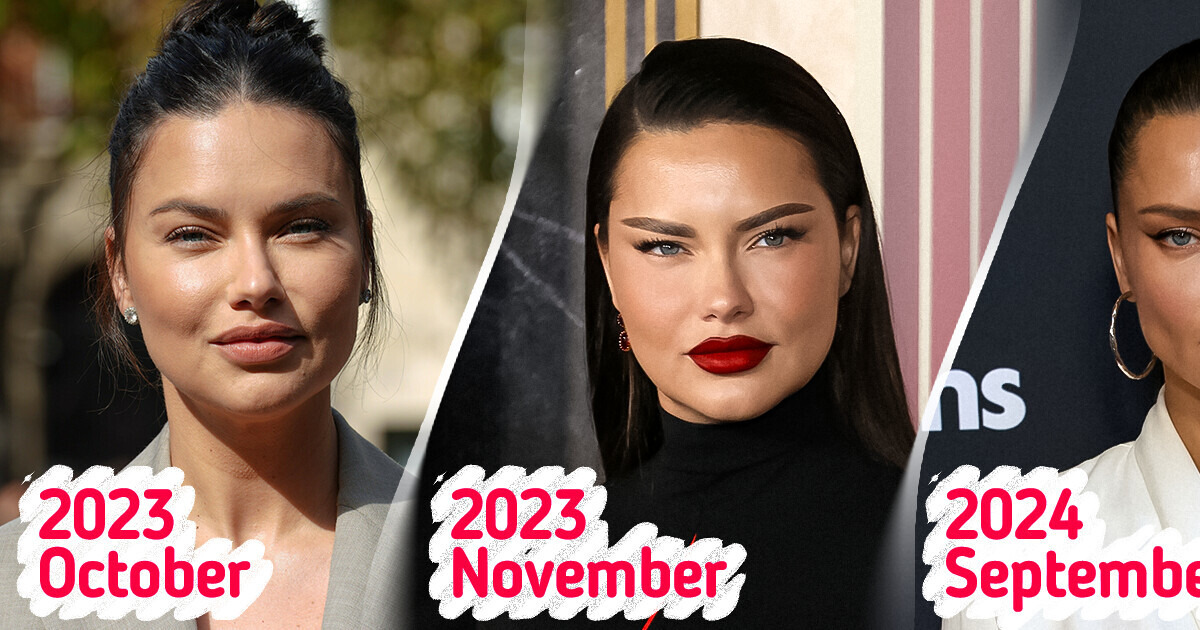 Adriana Lima Looks Different and Sparks Speculation She Has Had Her Fillers “Dissolved”