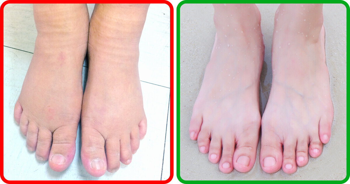 What Your Feet Might Be Telling You: 4 Troubling Health Signs to Watch For What Your Feet Might Be Telling You: 4 Troubling Health Signs to Watch For