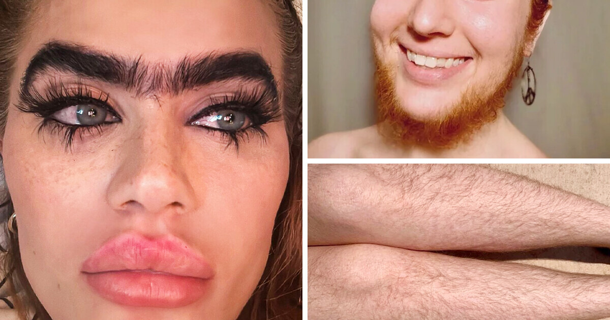 15 Women Who Confidently Rock Their Body Hair