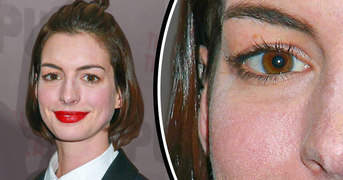 15 Celebrities Who Got Into an Awkward Situation but Kept on Smiling No Matter What